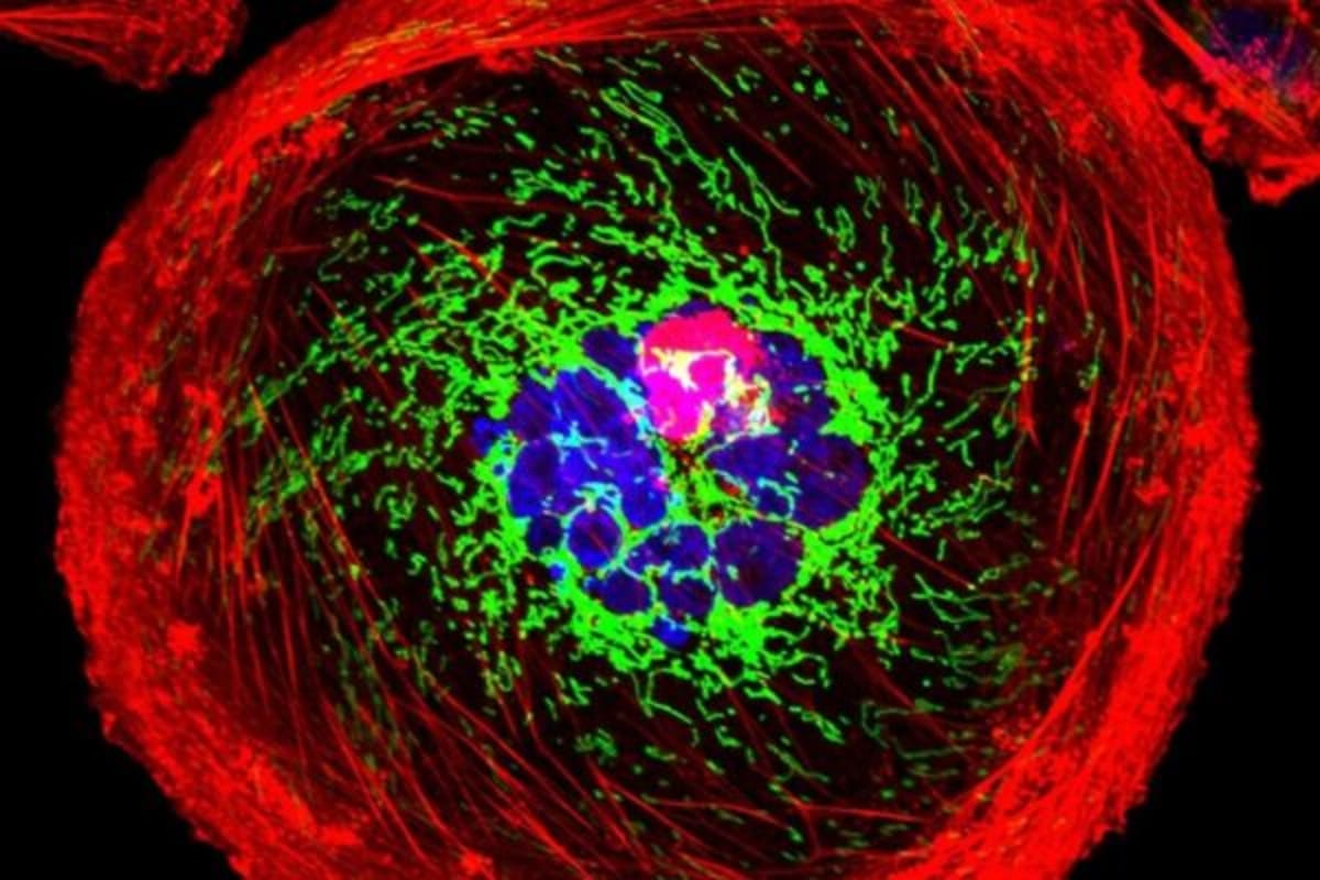 New Drug Extends Life for Hard-to-Treat Breast Cancer - Image 2