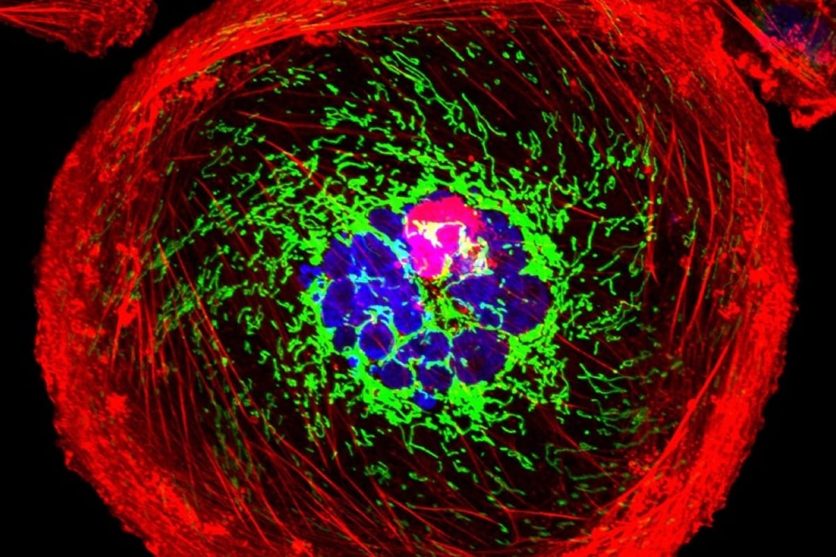 New Drug Extends Life for Hard-to-Treat Breast Cancer