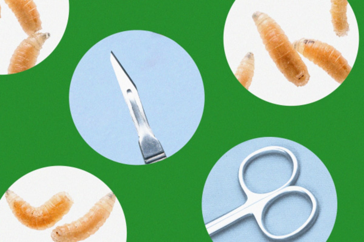 Tiny Maggots Clean Wounds Better Than Surgery Can - Image 3