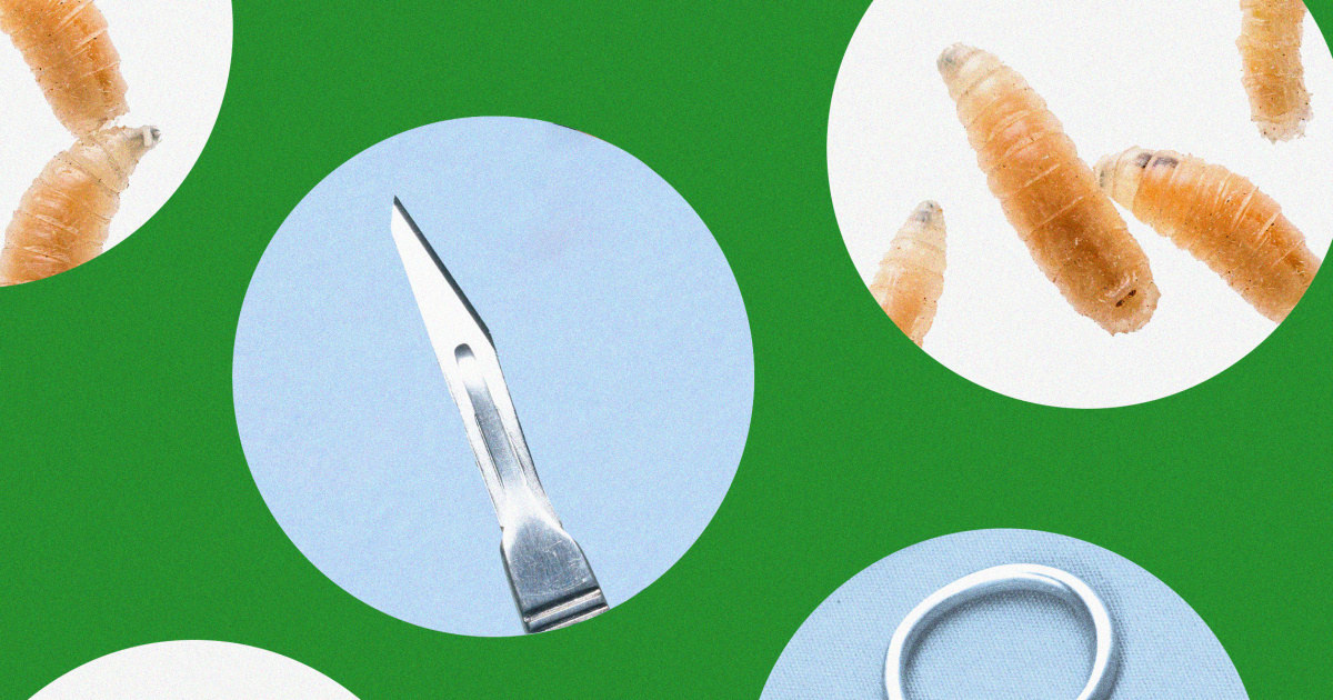 Close-up of sterile medical maggots in clinical laboratory container used for wound treatment
