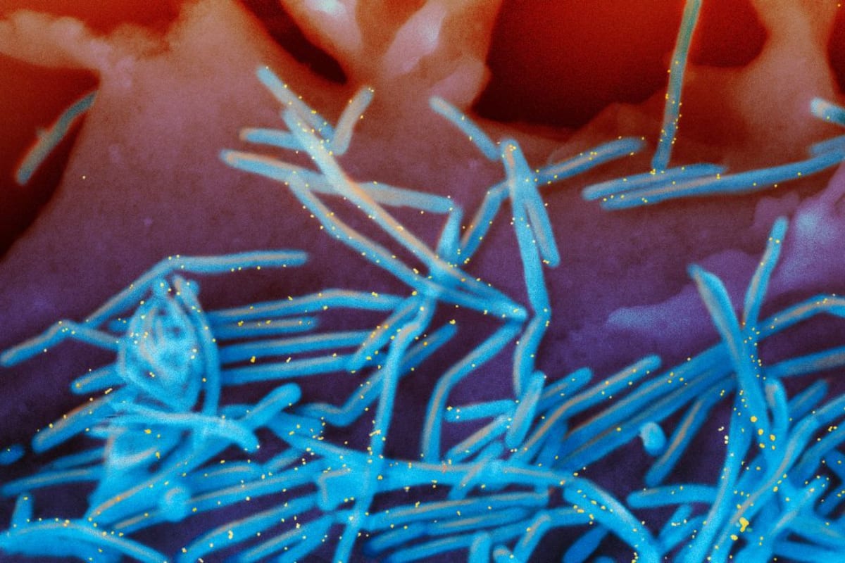 48 States Extend RSV Protection After Game-Changing Shot Works - Image 2