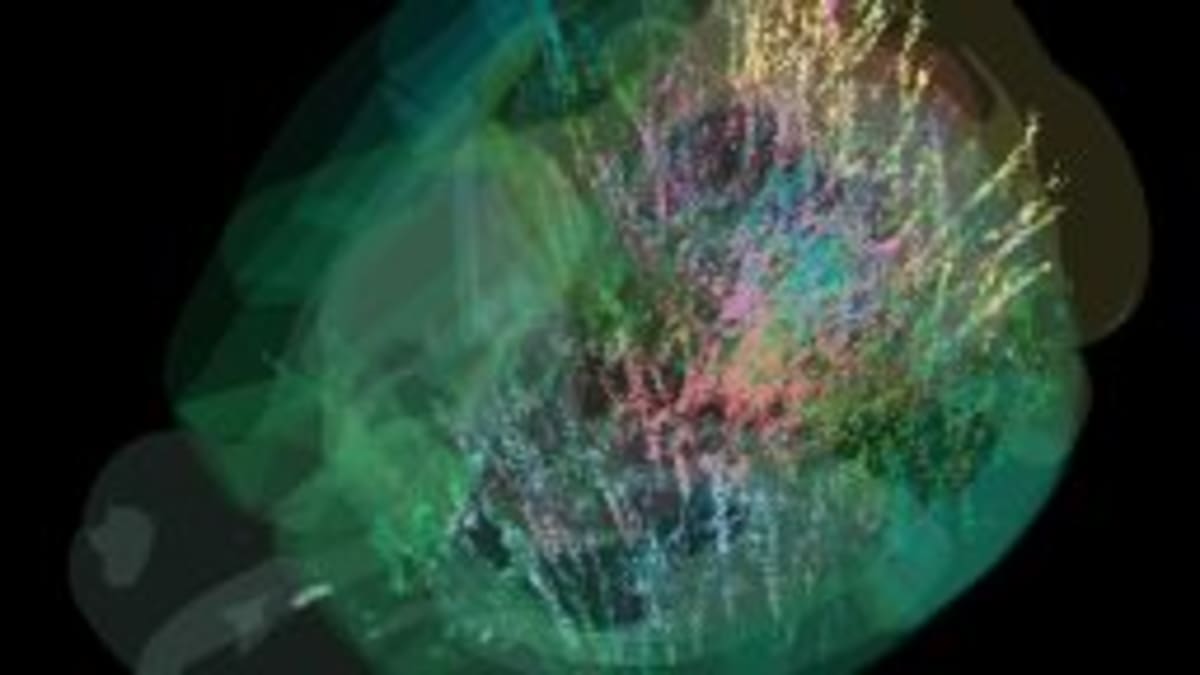 Scientists Map Autism Proteins, Opening Door to Treatments - Image 5