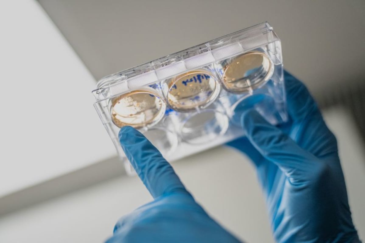 mRNA Cancer Vaccines Show Promise After Difficult Year - Image 5