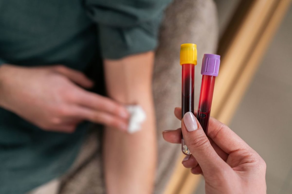 Blood Test Clue Could Help Catch Colon Cancer Earlier - Image 2