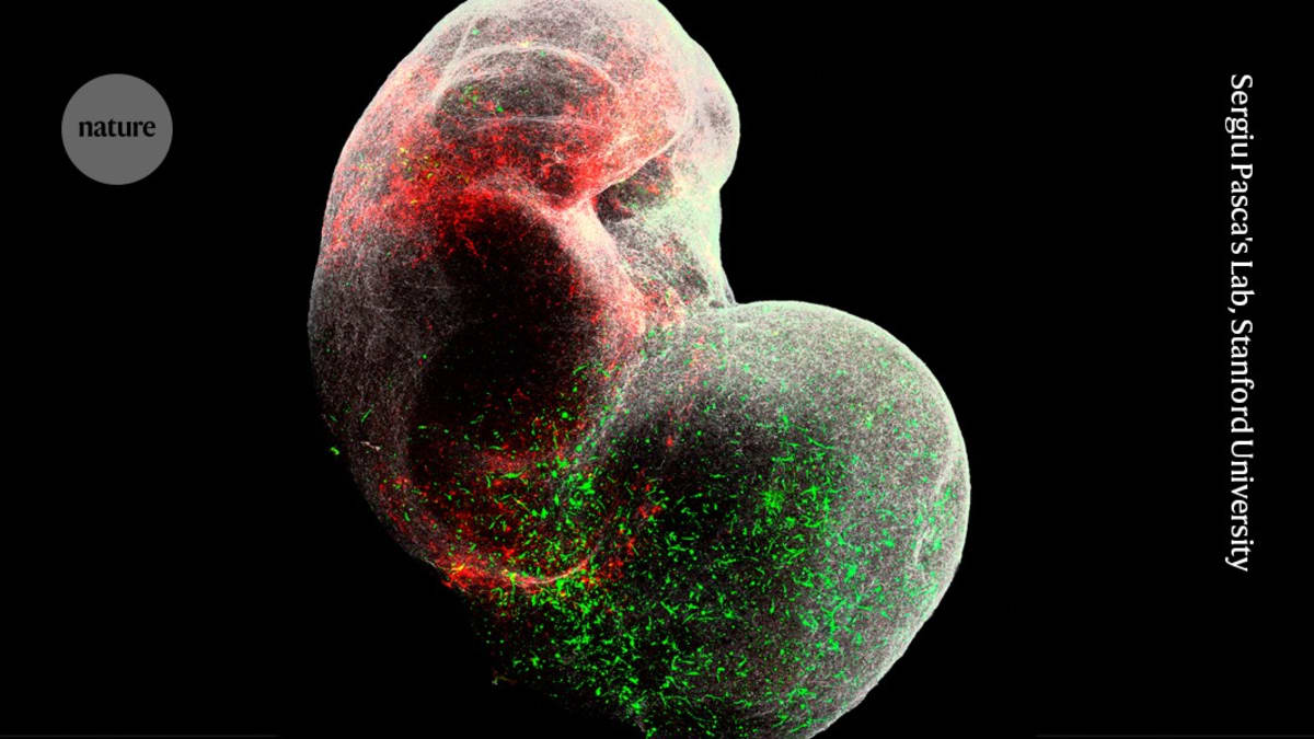 Green fluorescent neurons migrating inside a laboratory-grown brain organoid model