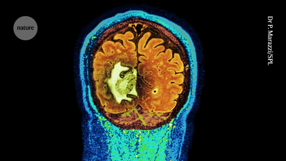 DNA Vaccine Shows Promise for Deadly Brain Cancer