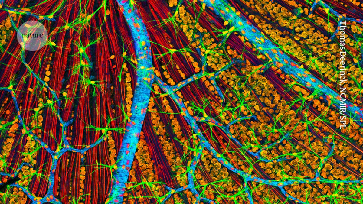 Red nerve fibers of optic nerve connecting eye to brain under microscope