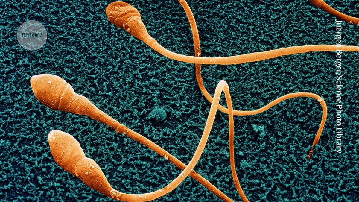 Colorized electron microscope image showing multiple human sperm cells in detail