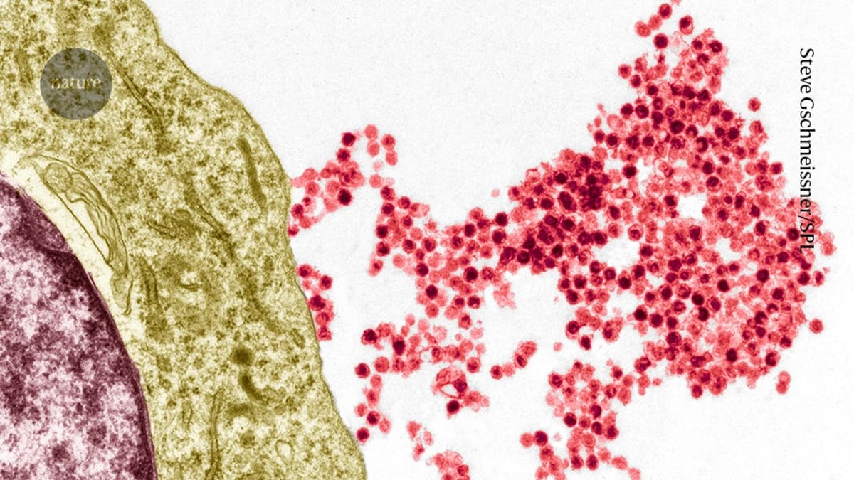 Scientists Discover How Common Virus Triggers MS