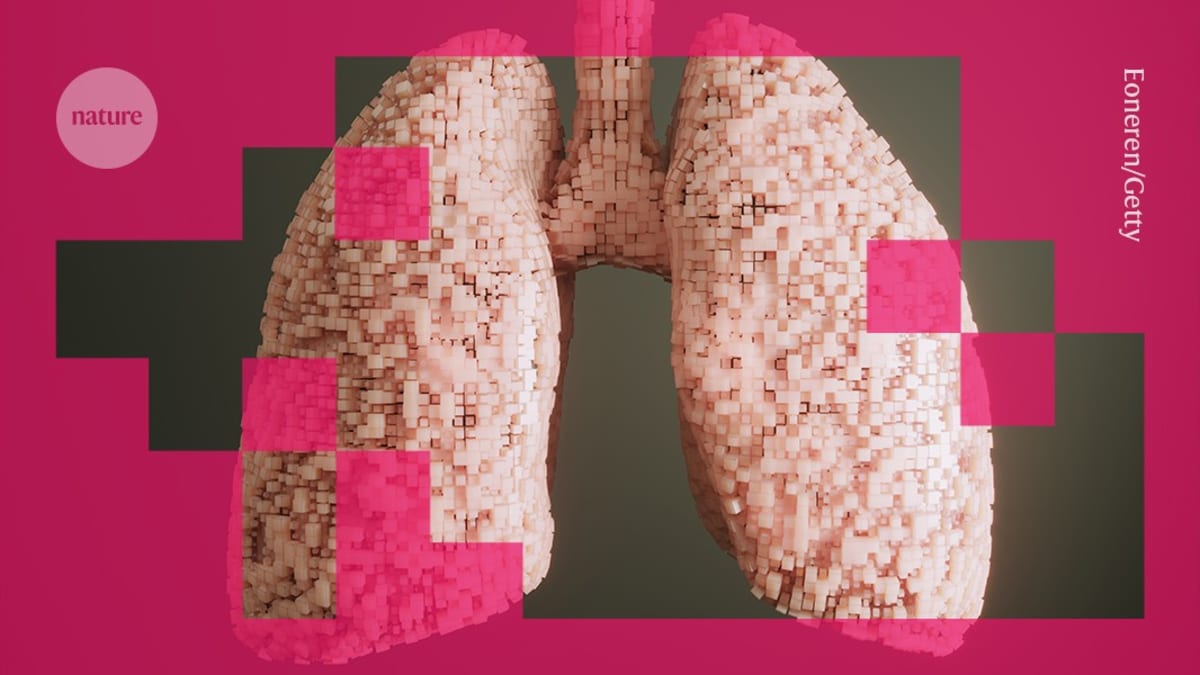 AI Team Discovers Promising Lung Cancer Treatment
