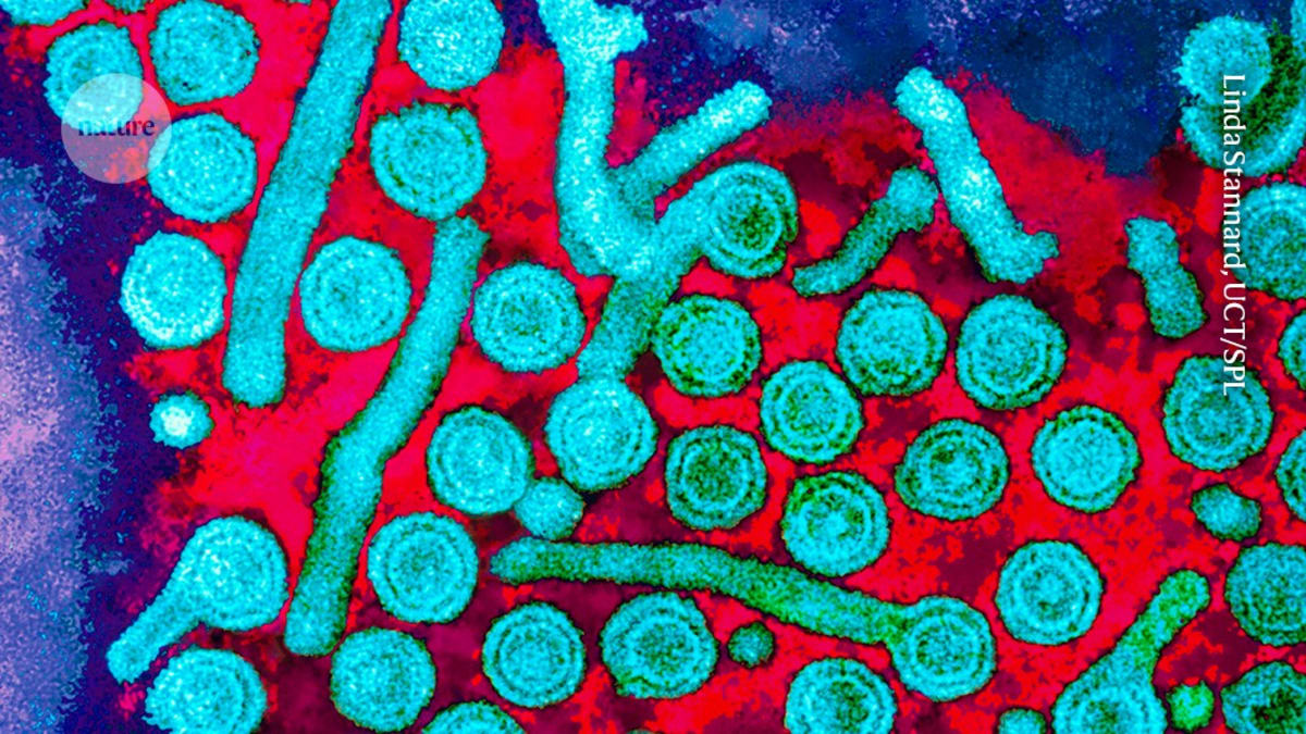 Microscopic view of hepatitis B virus particles in liver cells under laboratory magnification