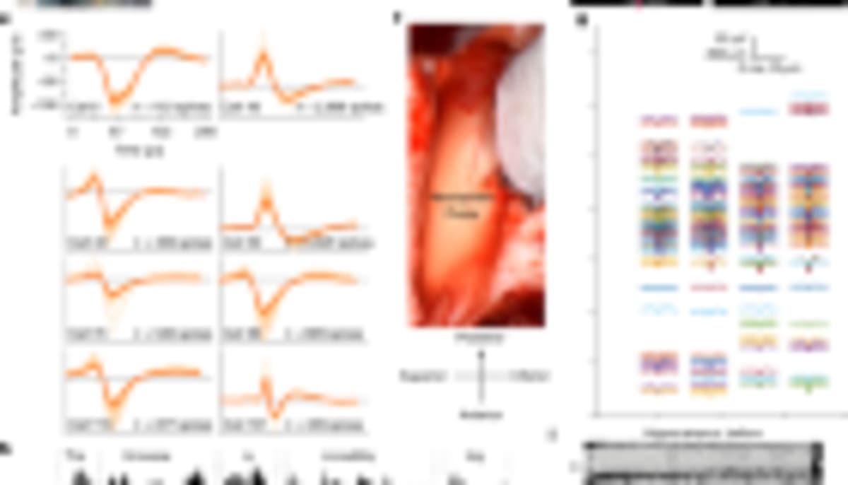 Brain Under Anesthesia Can Still Learn and Predict Words - Image 5