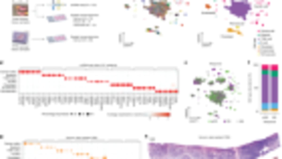 DNA Vaccine Shows Promise for Deadly Brain Cancer - Image 3