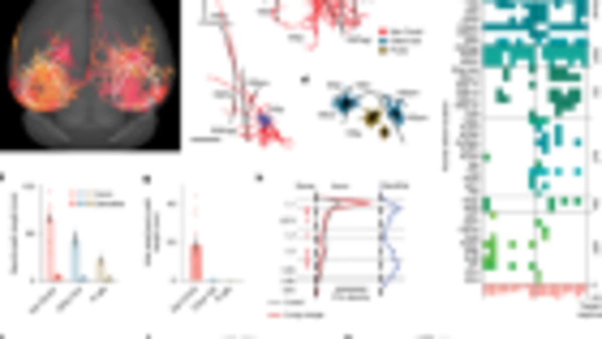 Brain Implant Lets Paralyzed People Talk and Gesture at Once - Image 5