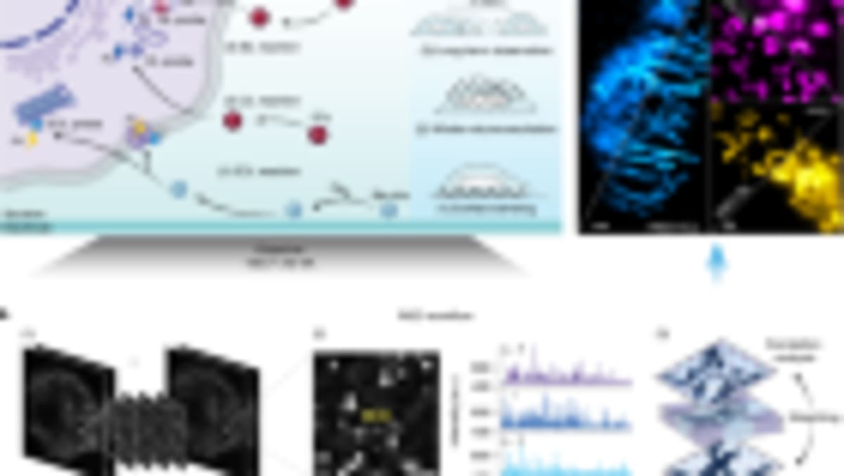 First Narcolepsy Drug Treats Root Cause, Not Just Symptoms - Image 4