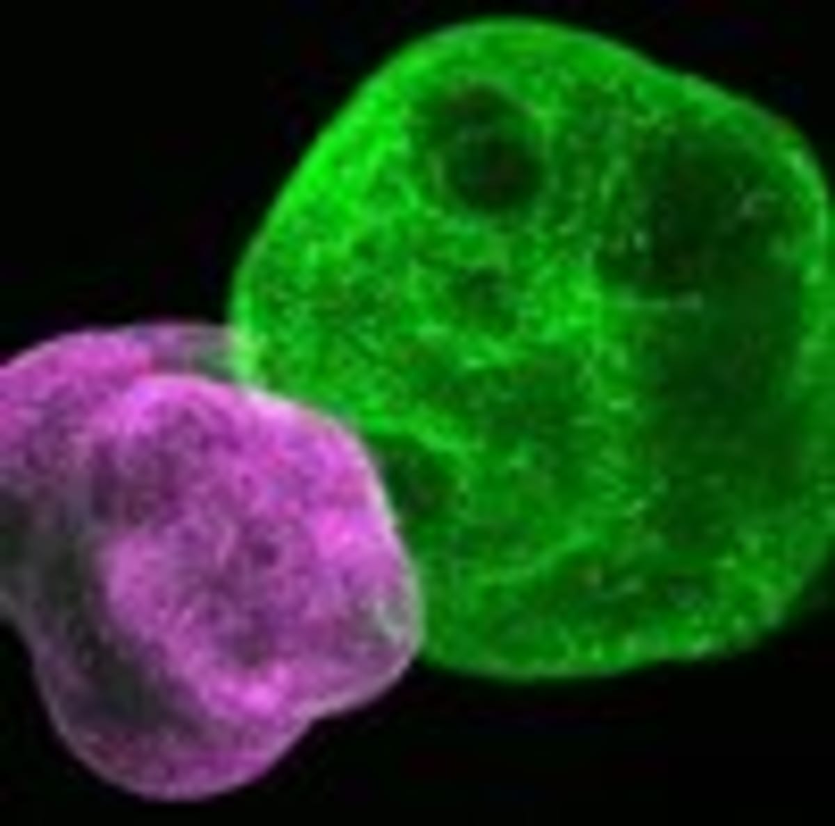 Scientists Ready to Fix Brain Diseases Like Alzheimer's - Image 5