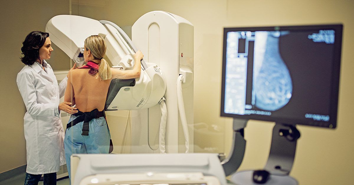 Medical researcher examining mammogram images showing breast density reduction in cancer prevention study