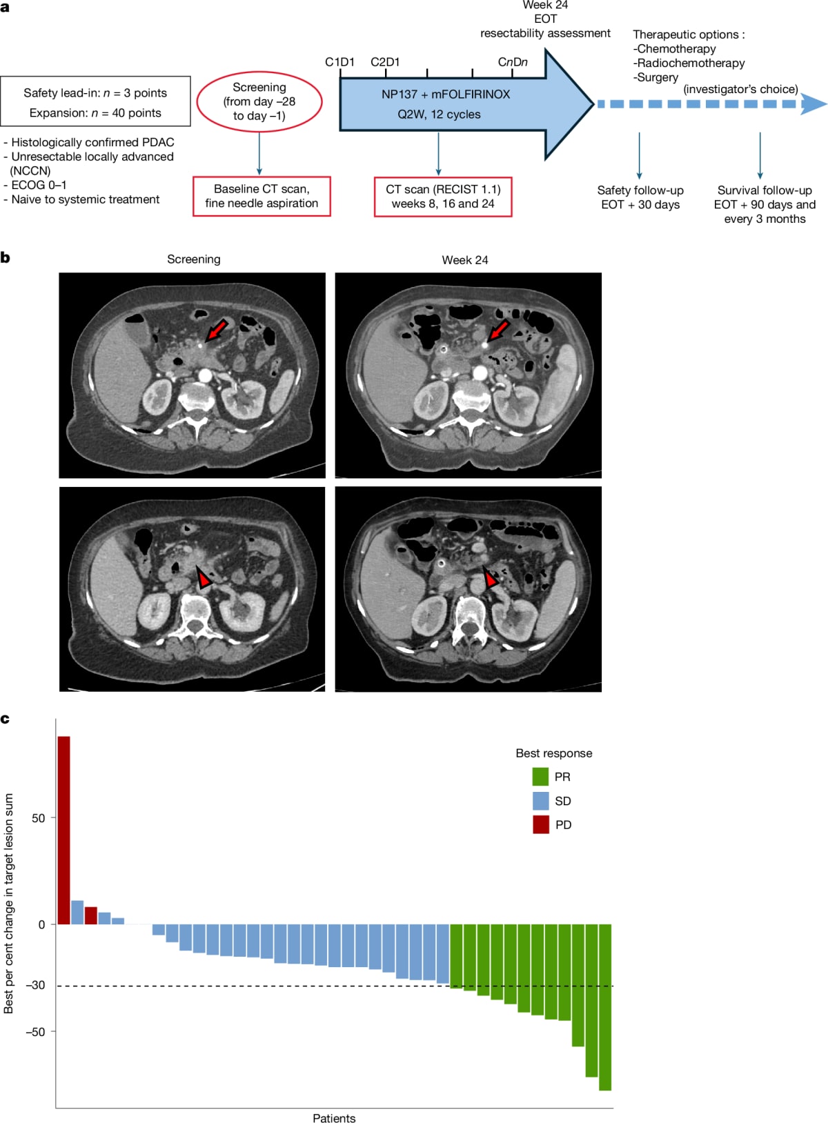 New Drug Combo Doubles Survival Time for Pancreatic Cancer - Image 2