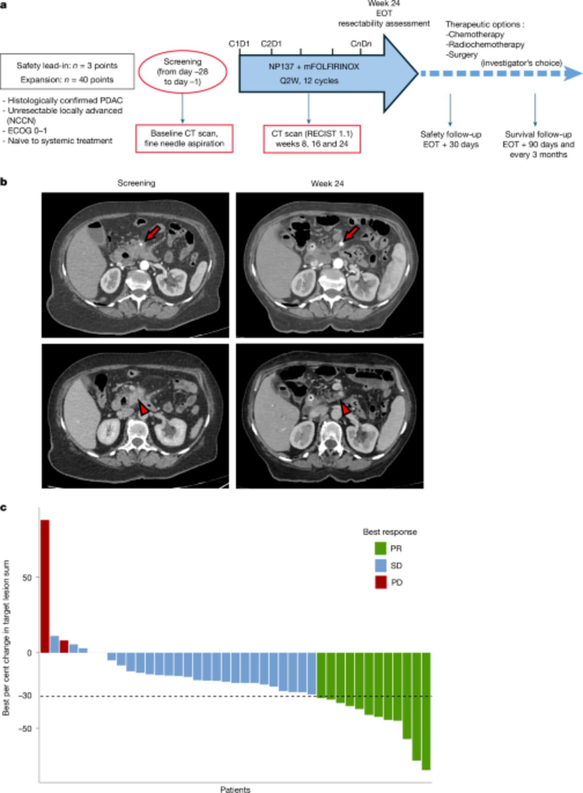 ** Medical researchers examining pancreatic cancer treatment scans showing tumor reduction after combination therapy