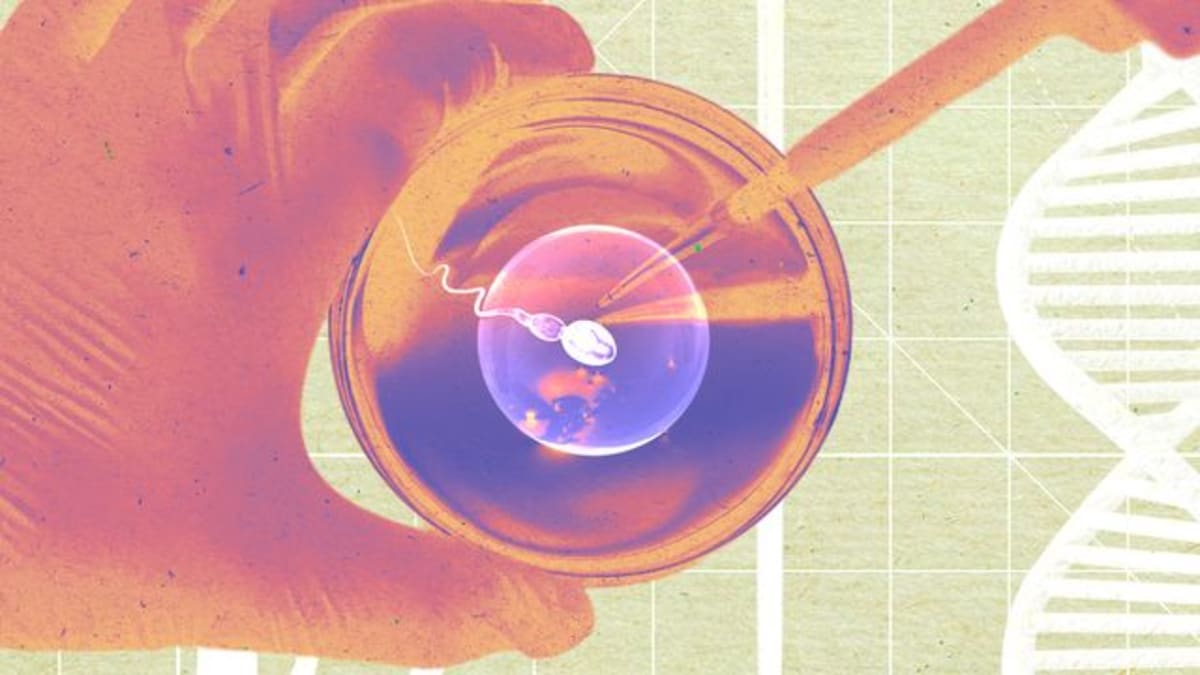 Alzheimer's Drugs Now Slow Disease by 3+ Years - Image 5