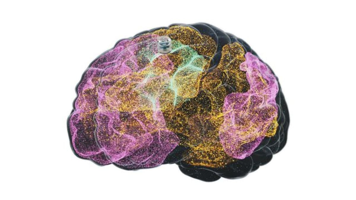 Alzheimer's Drugs Now Slow Disease by 3+ Years - Image 4