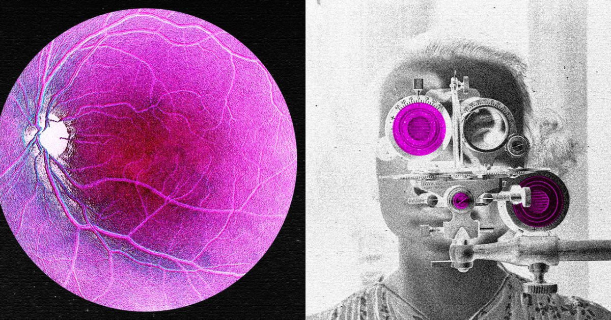 First Drug to Reverse Age-Related Blindness Enters Trials