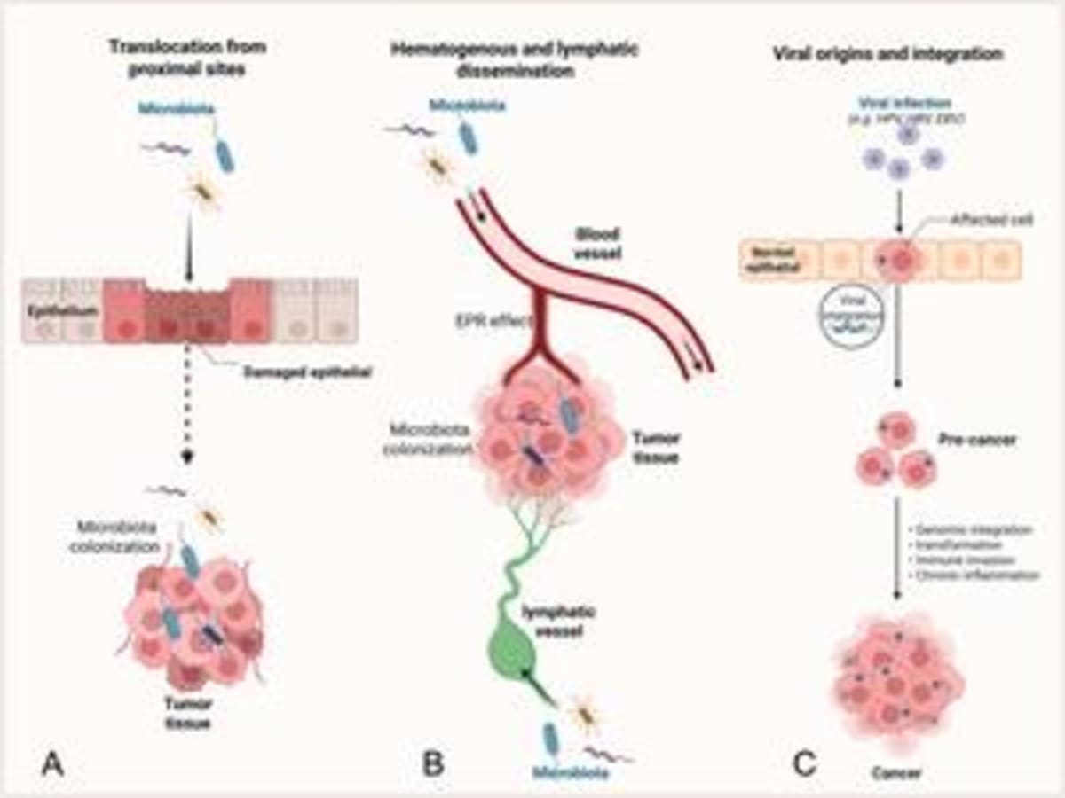 Scientific diagram showing bacterial origins and pathways into tumor microenvironments for cancer research