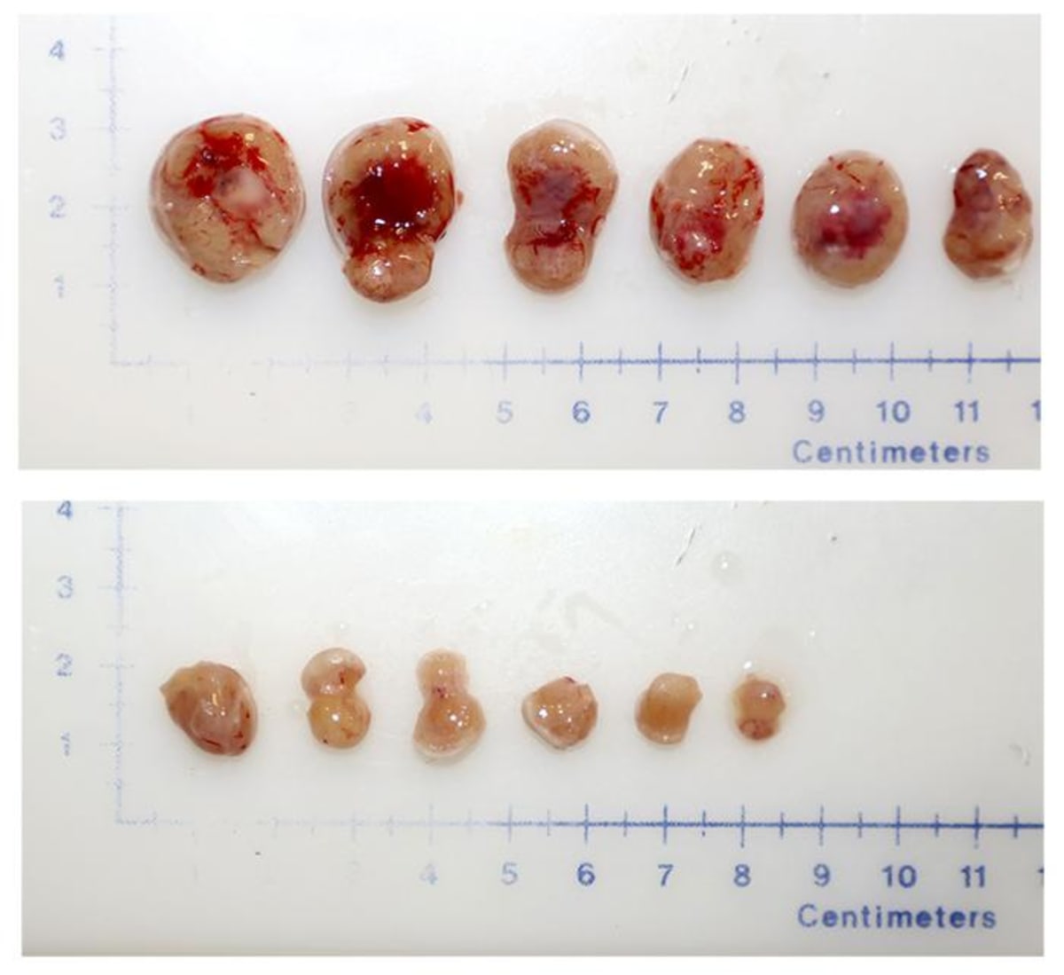 New Drug Target Could Stop Aggressive Prostate Cancer - Image 2