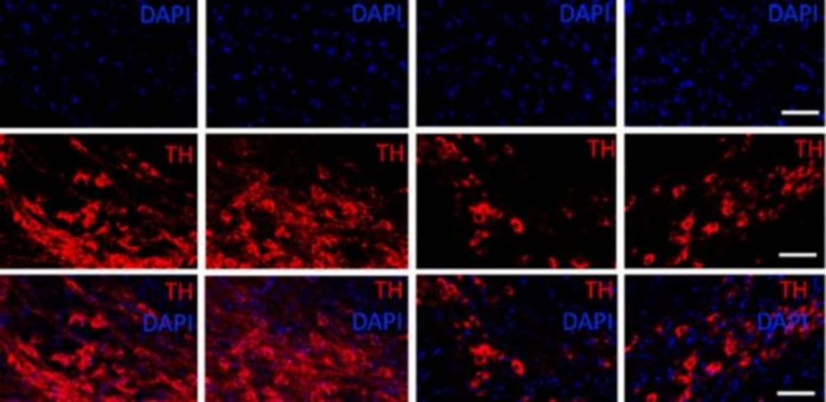 Brazilian Scientists Find New Way to Protect Parkinson's Cells - Image 2