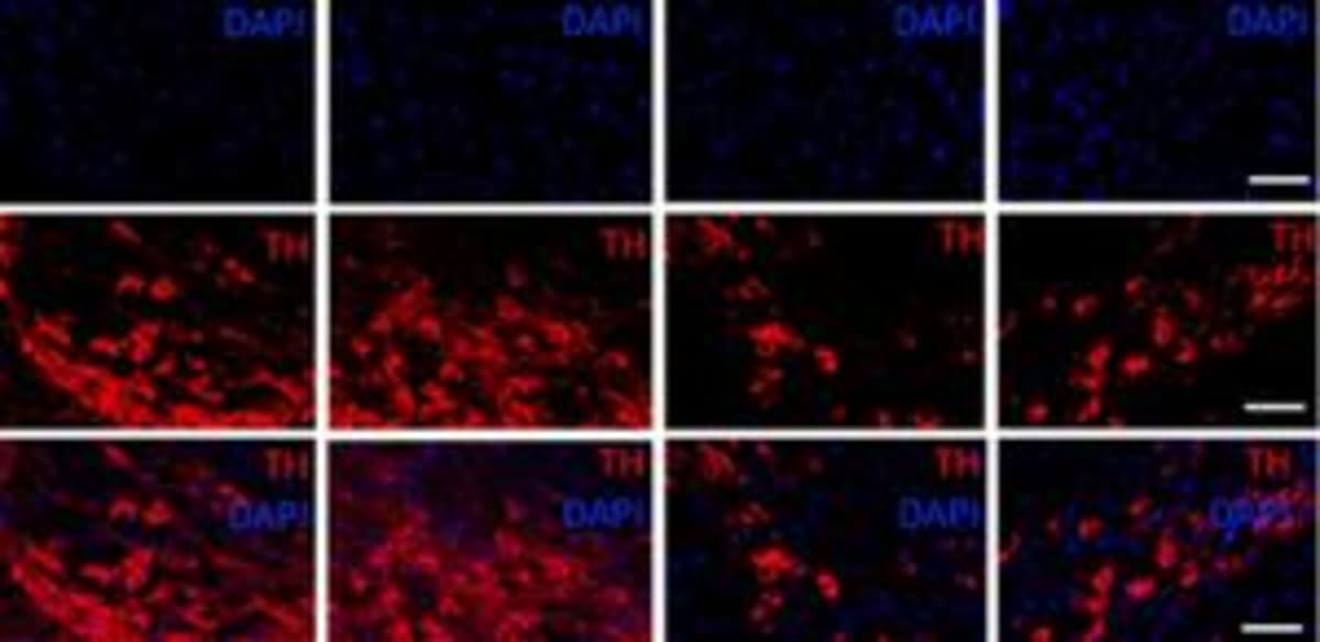 Brazilian Scientists Find New Way to Protect Parkinson's Cells