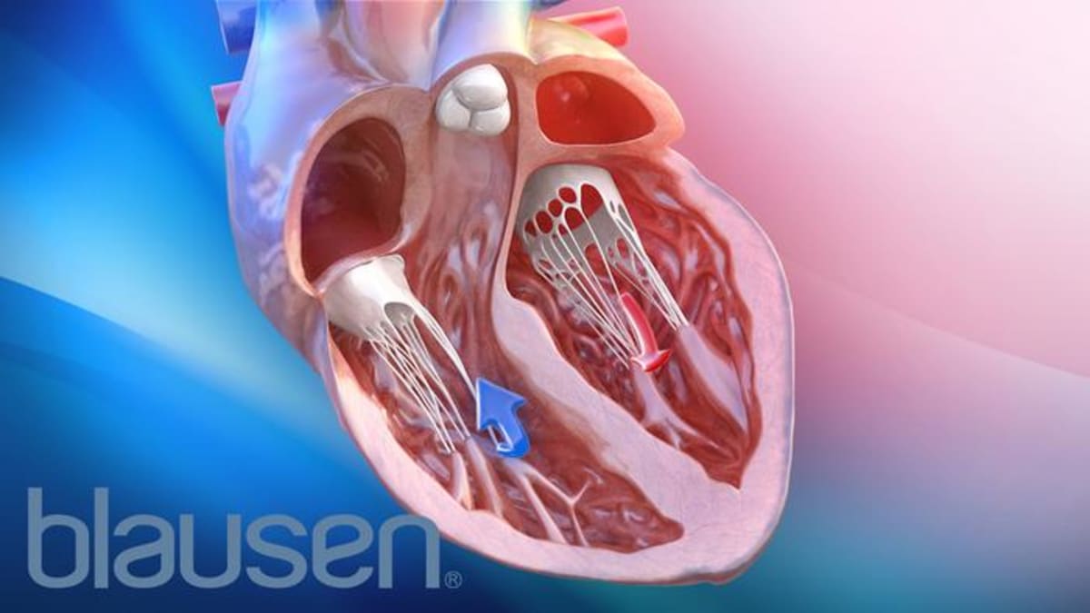 Weight Loss Reverses Heart Damage in Obesity Patients - Image 2