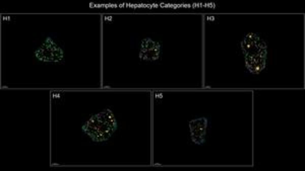 New Cell Imaging Method Could Transform Disease Detection