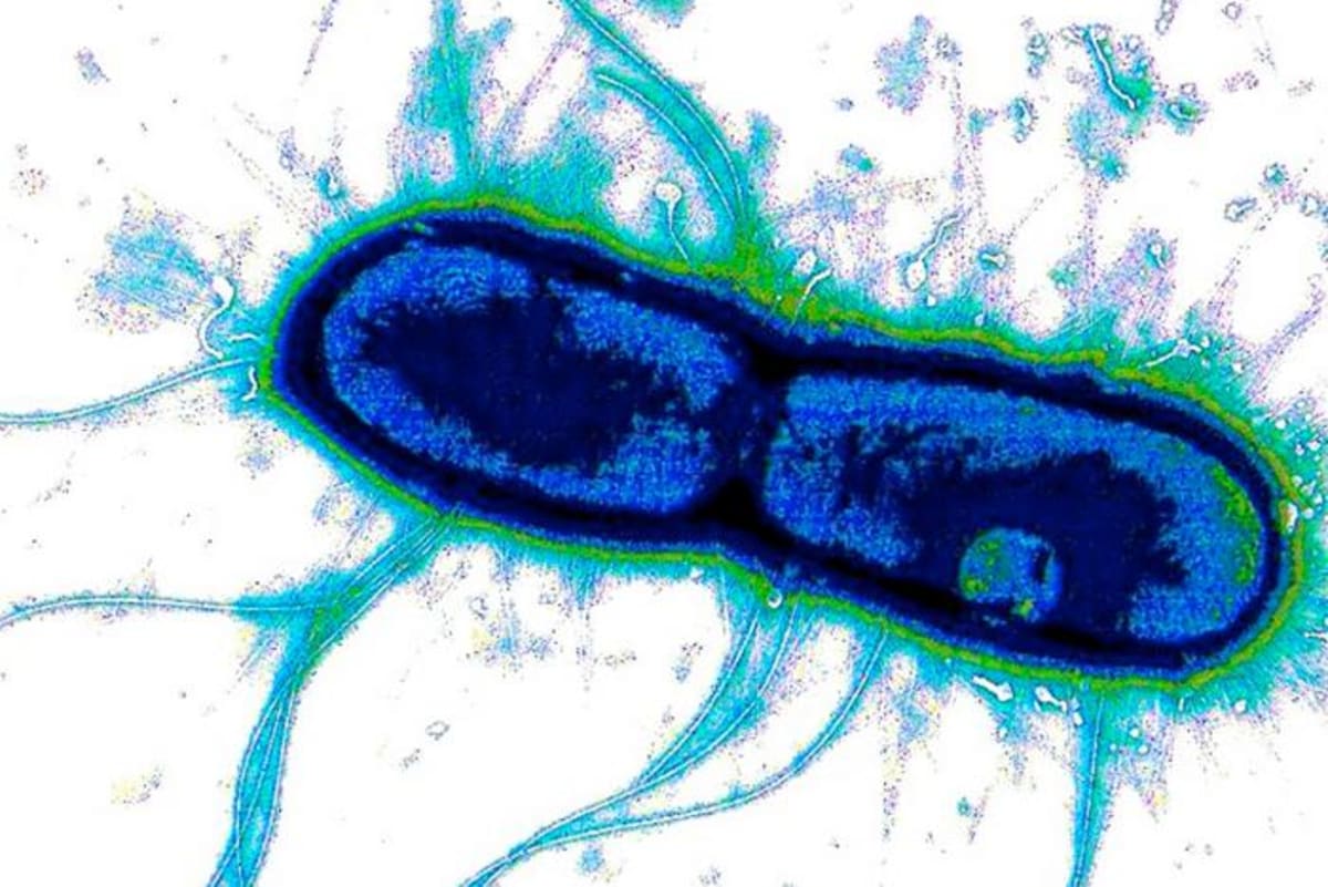 Scientists Find Weak Spot in Deadly Diarrhea Bacteria - Image 2