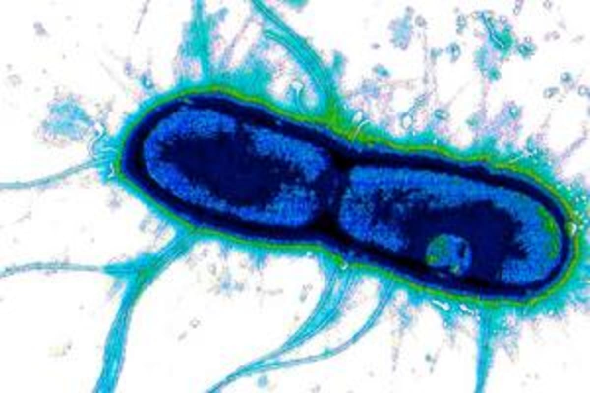 Scientists Find Weak Spot in Deadly Diarrhea Bacteria