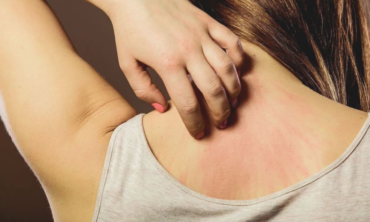 Common Lupus Drug Cuts Heart Disease Risk by Half
