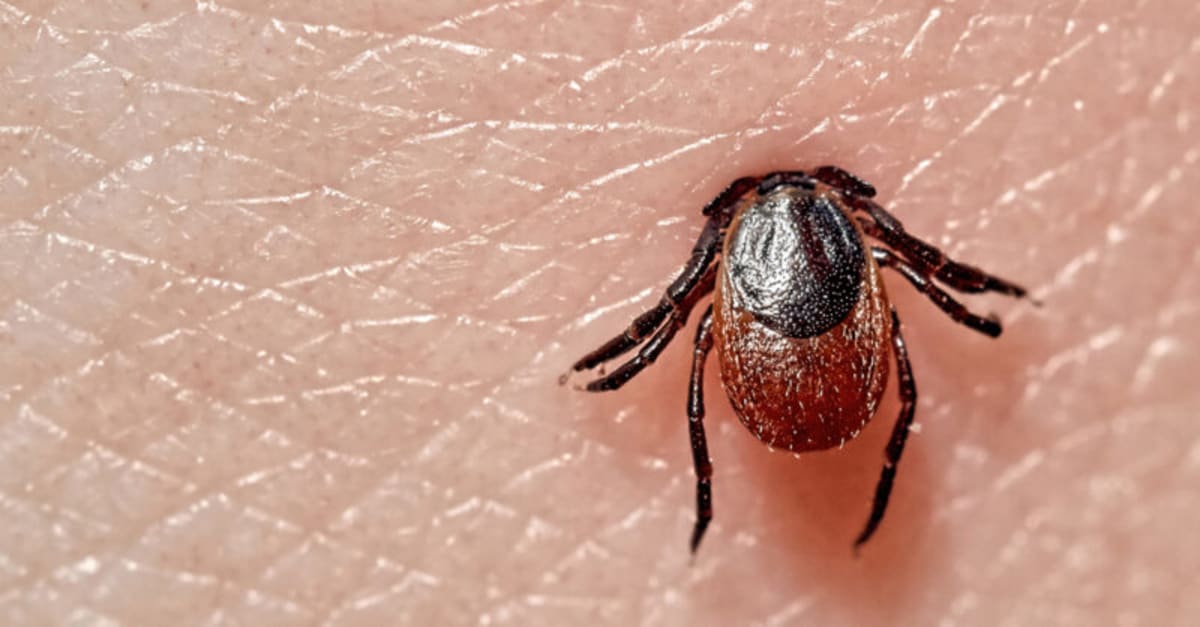 Blood Exchange Cuts Death Rate from Rare Tick Disease 73% - Image 2
