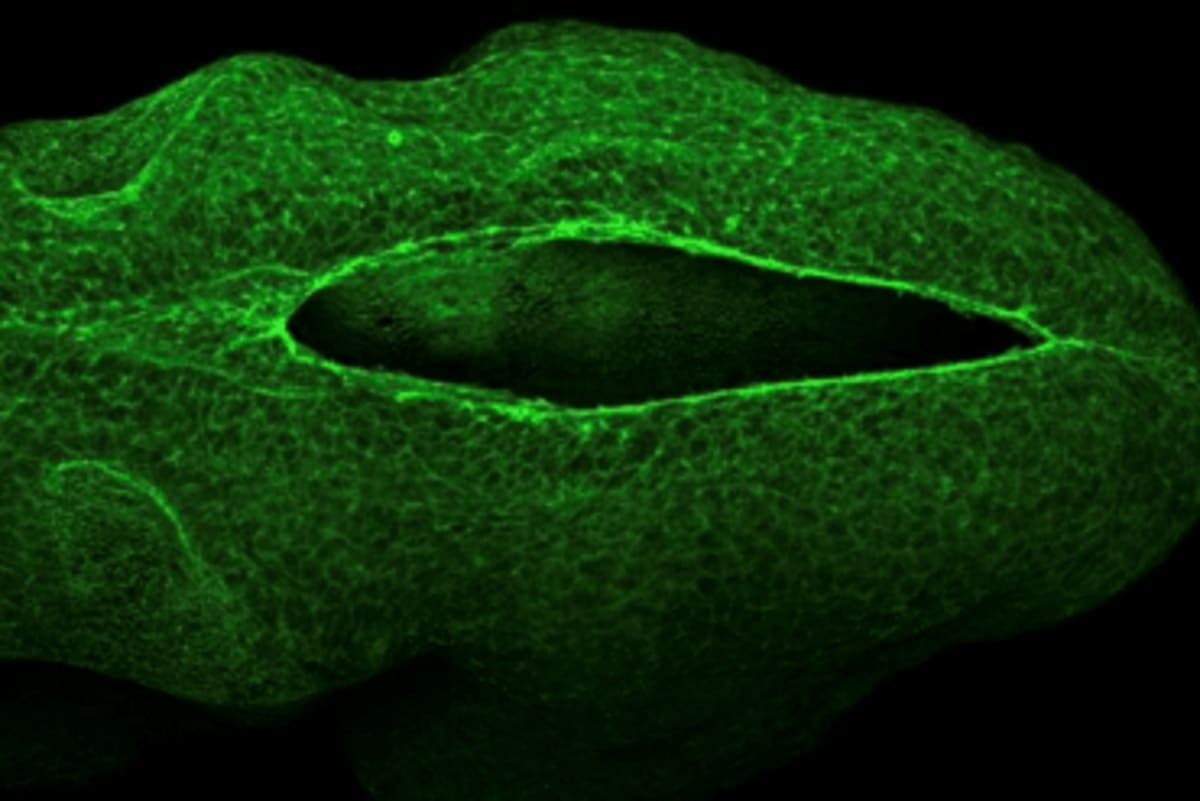 Gut Test Predicts Parkinson's Years Before Symptoms - Image 2