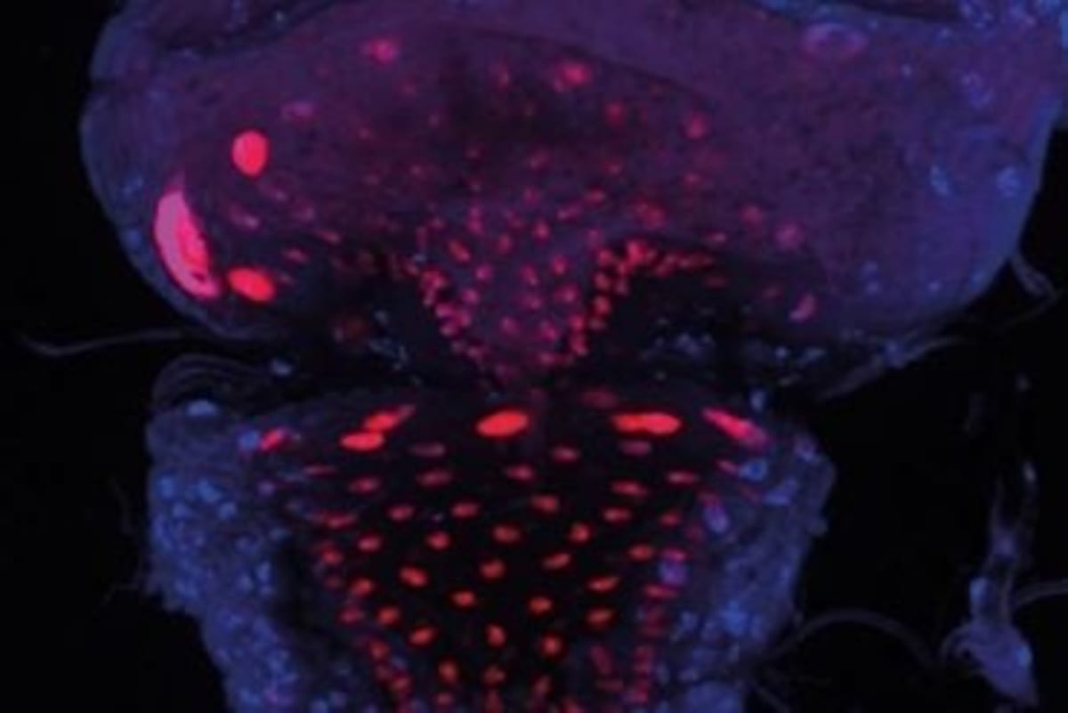 Weight-Loss Drug Eases Depression Through Gut Bacteria - Image 3