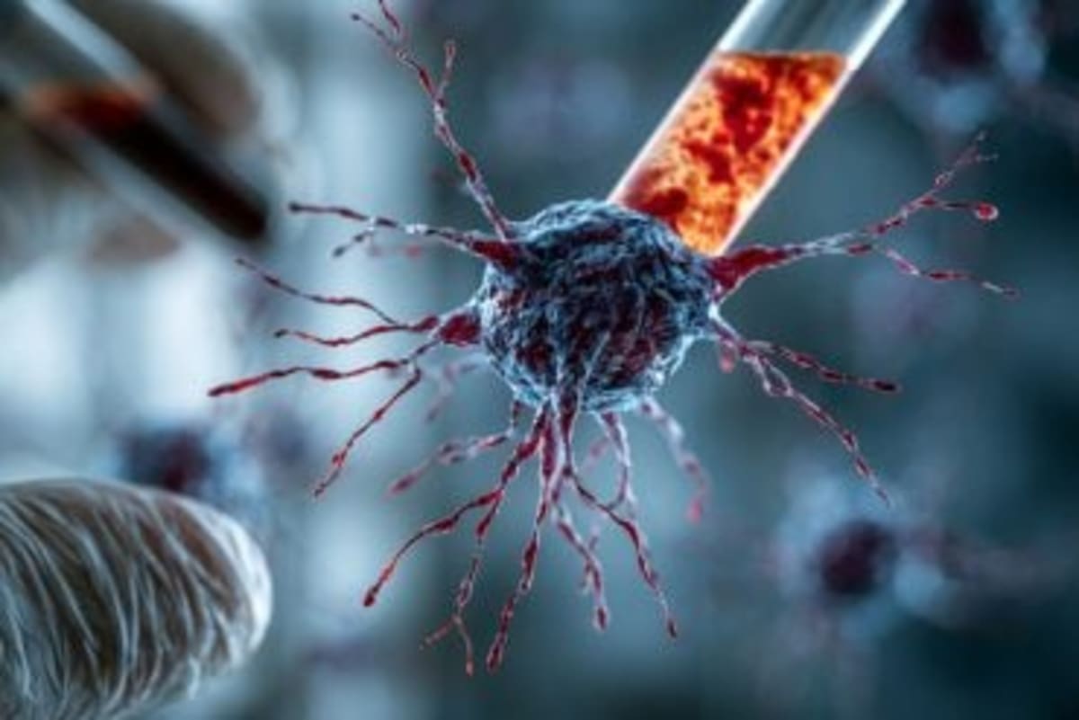 Blood Test Predicts Alzheimer's Risk 5 Years Early - Image 5