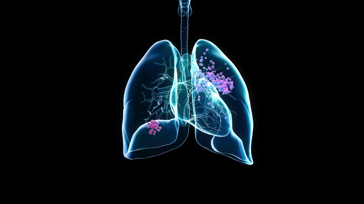 Cancer patient consulting with doctor about new treatment options in medical office