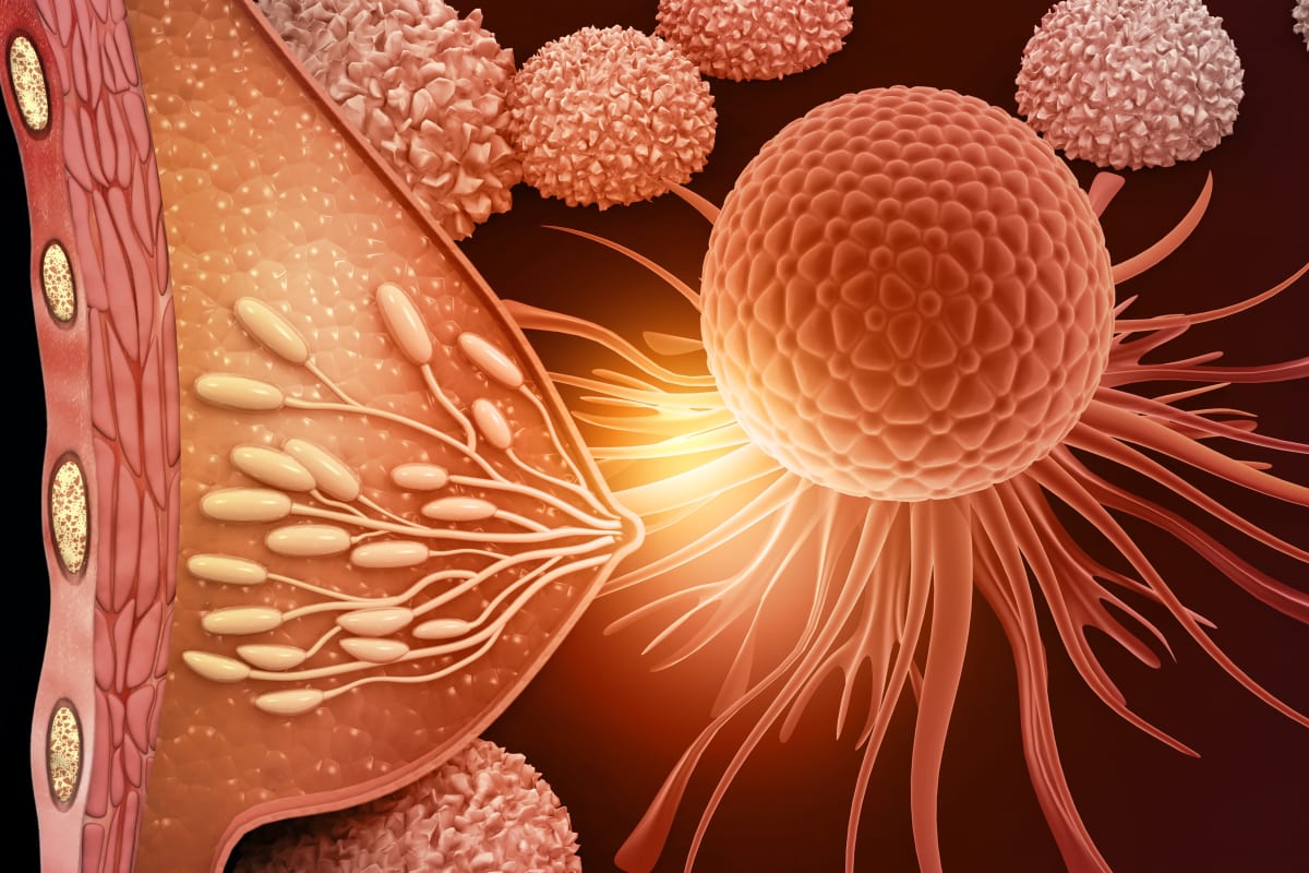 FDA Approves New Treatment for Common Breast Cancer Type - Image 2