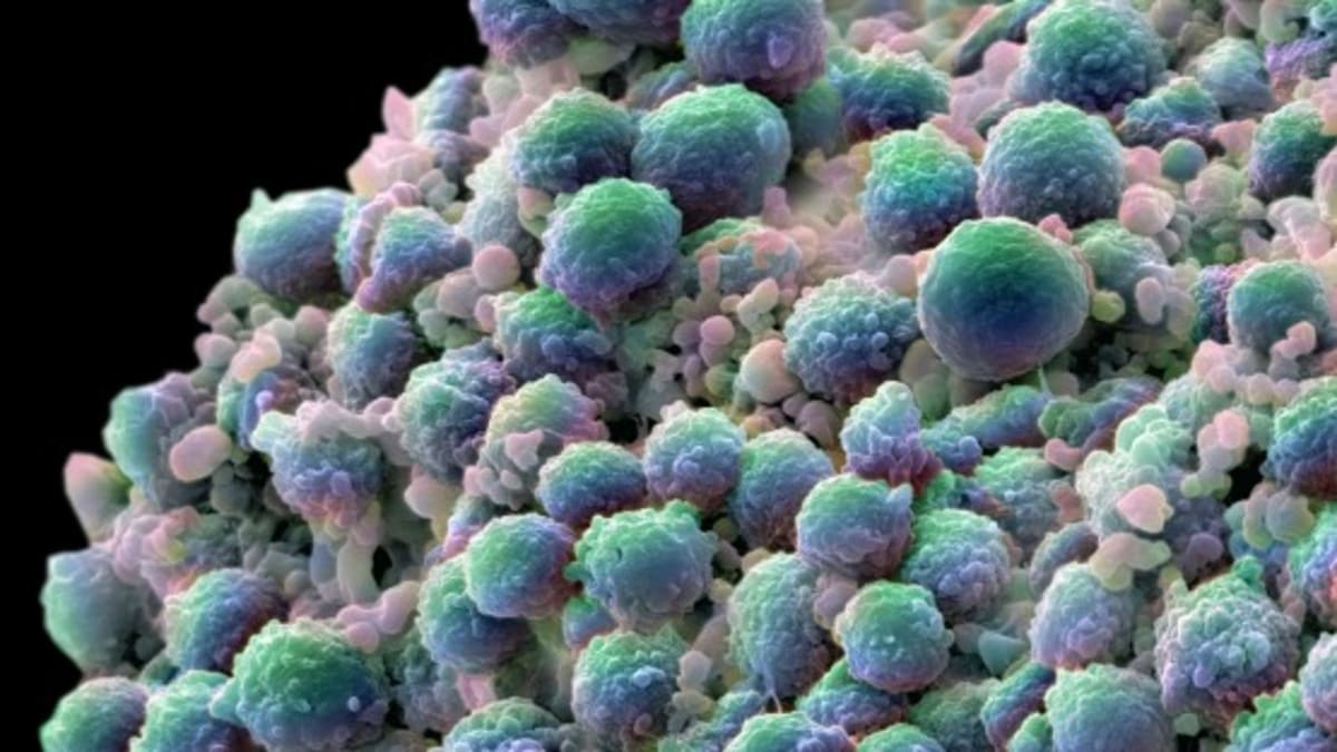 Microscopic view of ultrasmall fluorescent silica nanoparticles used in Cornell cancer research breakthrough