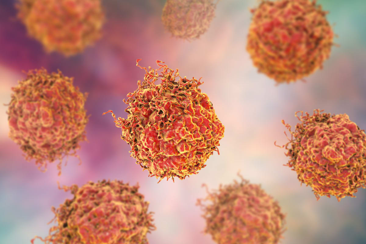 New Drug Combo Boosts Prostate Cancer Survival by 5%
