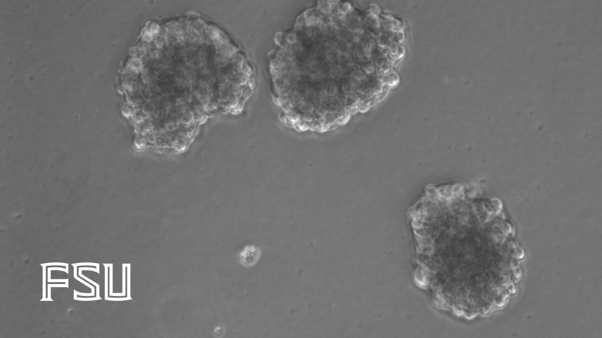 Microscopic view of stem cells releasing extracellular vesicles for stroke treatment research