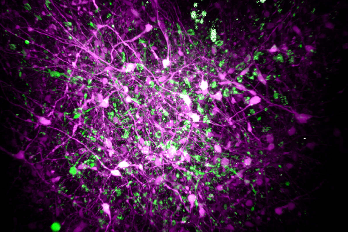 3D brain organoid cultures showing neurons labeled in purple, white, and green fluorescent colors