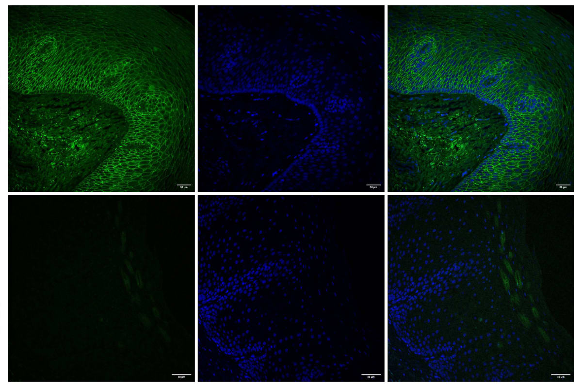 Microscope images showing esophageal tissue before and after gel treatment application