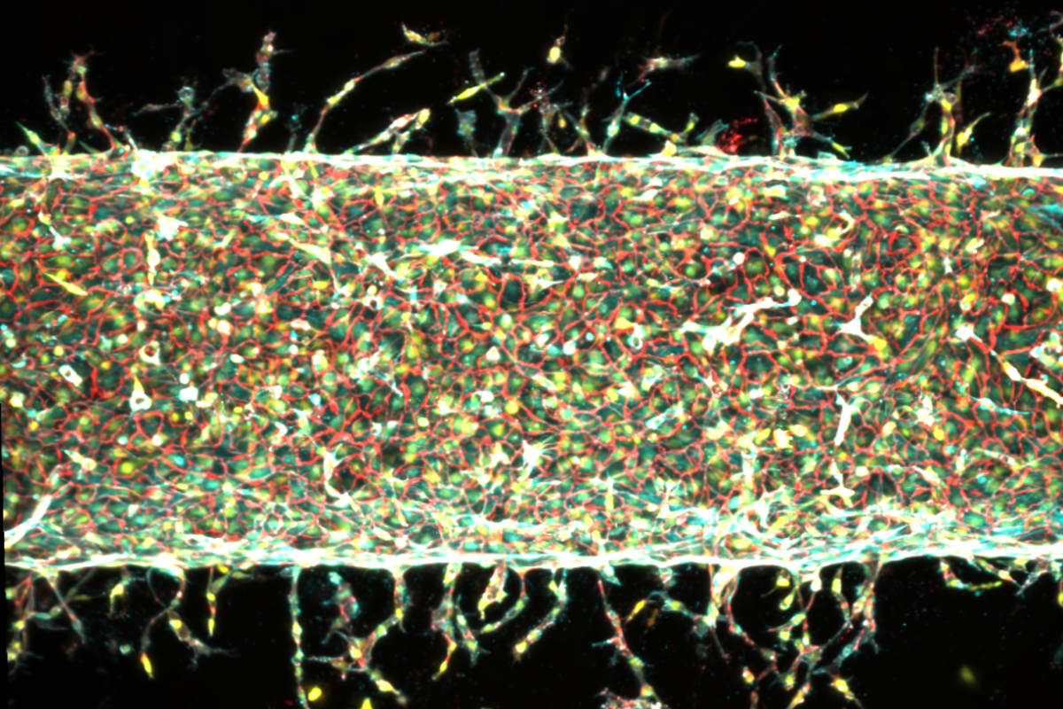 MIT Engineers Control Blood Vessel Growth With Stretching