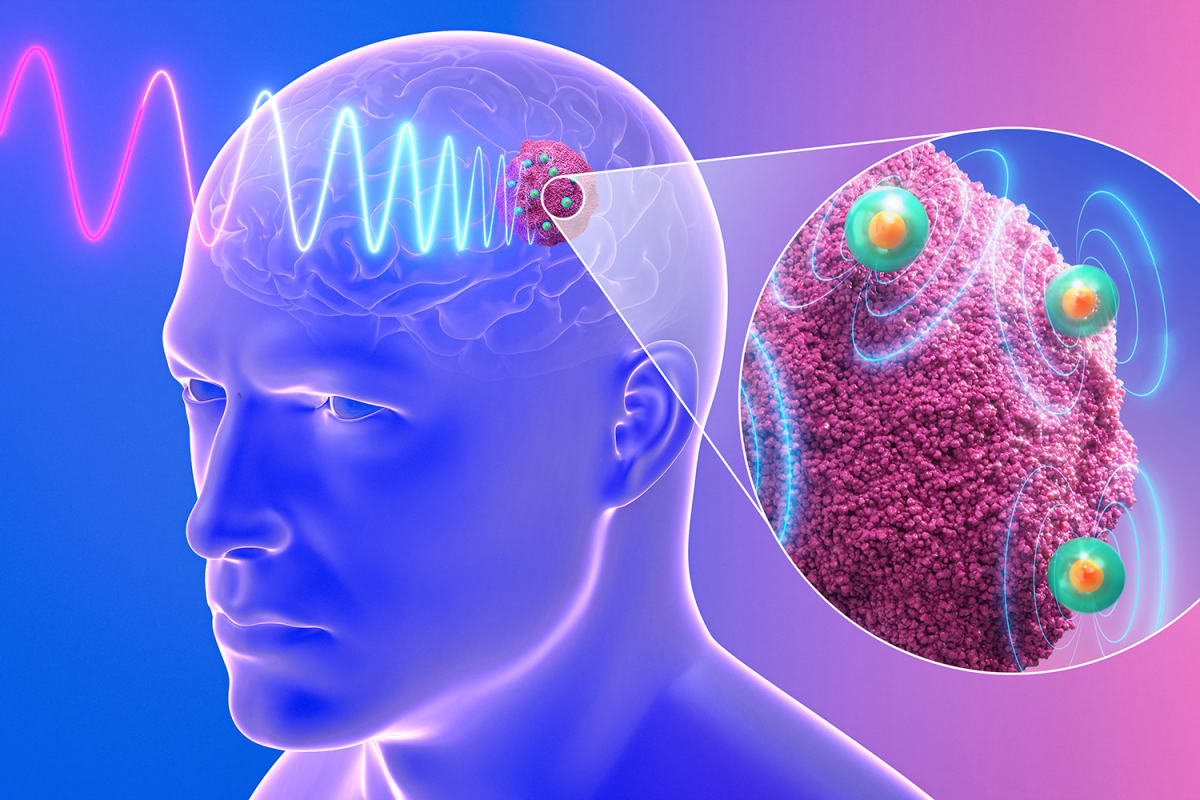 MIT's Tiny Nanoantennas Kill Brain Cancer Without Surgery