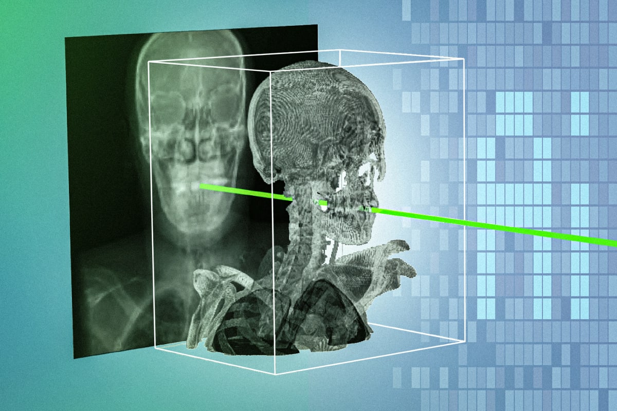 AI system visualization showing X-ray matching with 3D medical scan for surgical navigation