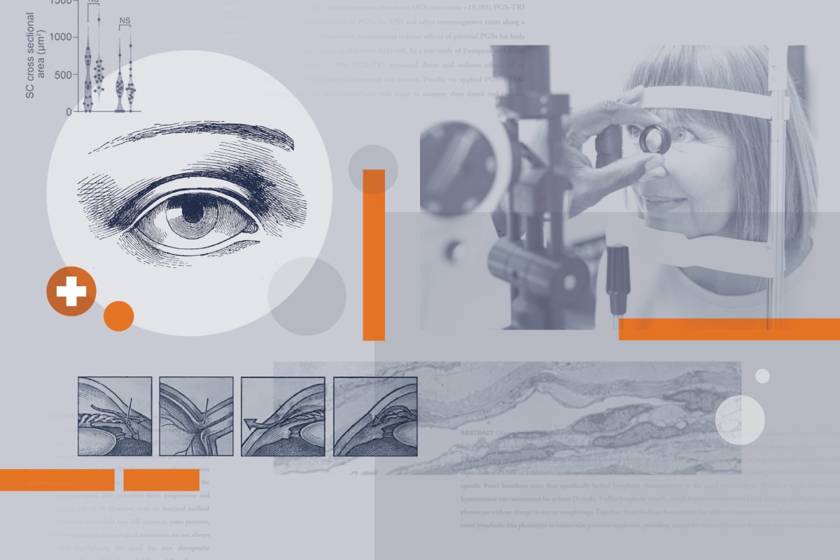 UVA Scientists Develop Gene Therapy to Treat Glaucoma